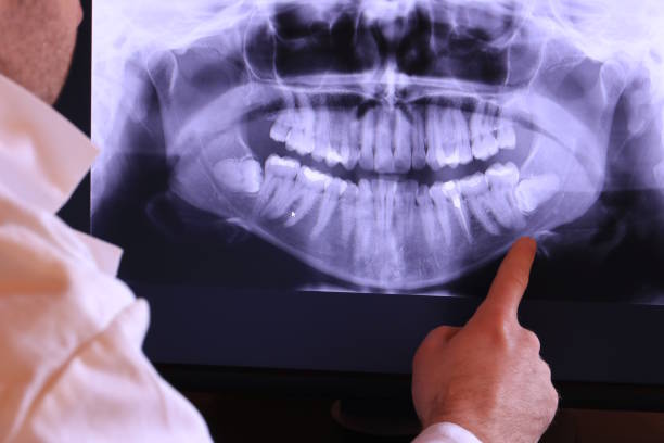 Urgent Tooth Repair in WY