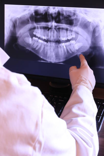 Best Chipped Tooth Repair Near Me  in Mills, WY